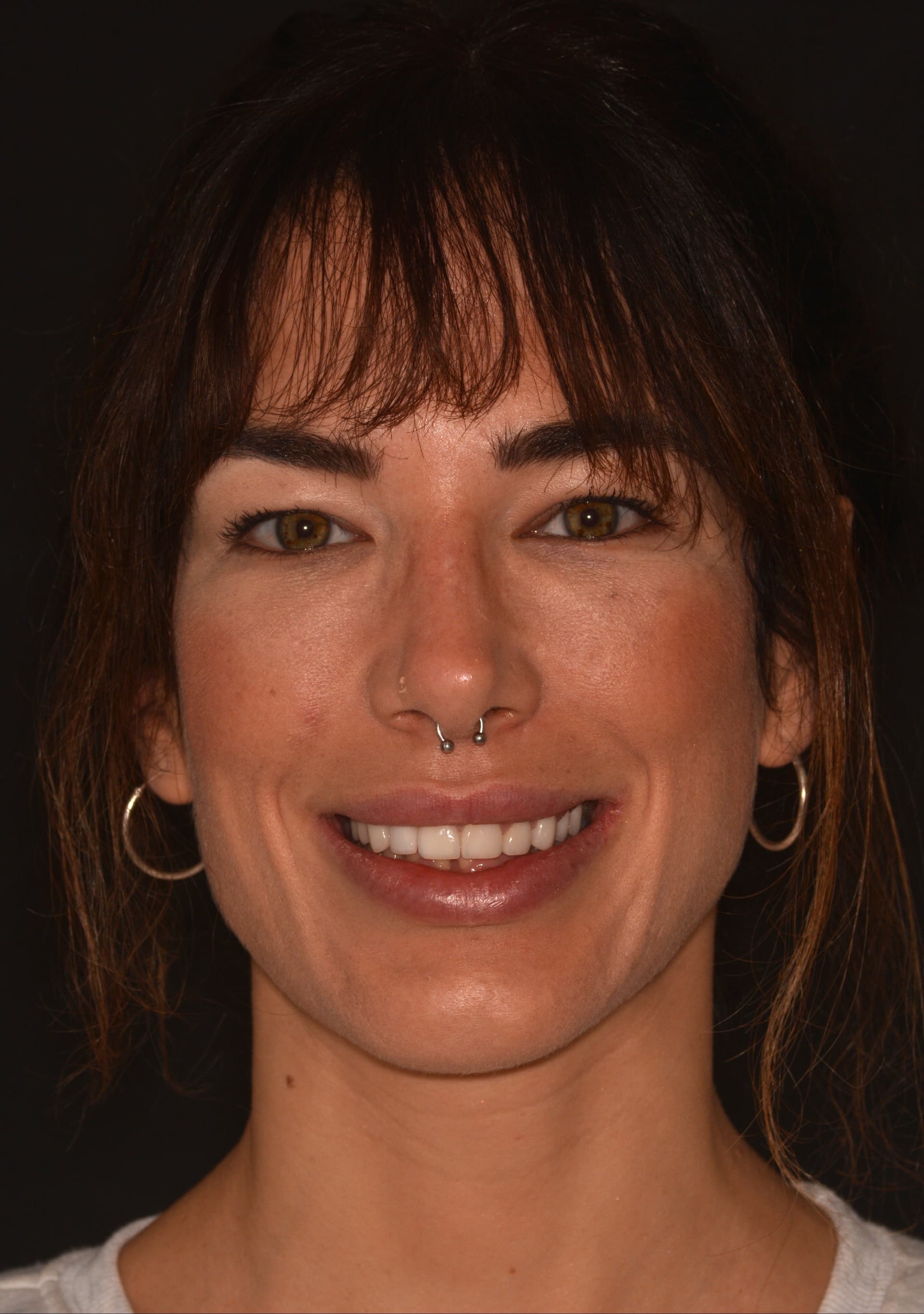 Después del tratamiento